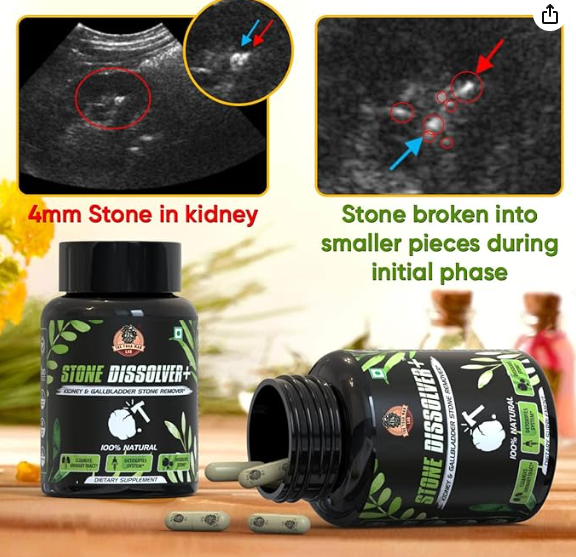 SUPLEMENTO RENAL